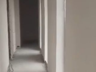 გიპერით ლესვა თანამედროვე აპარატით სურათი 5